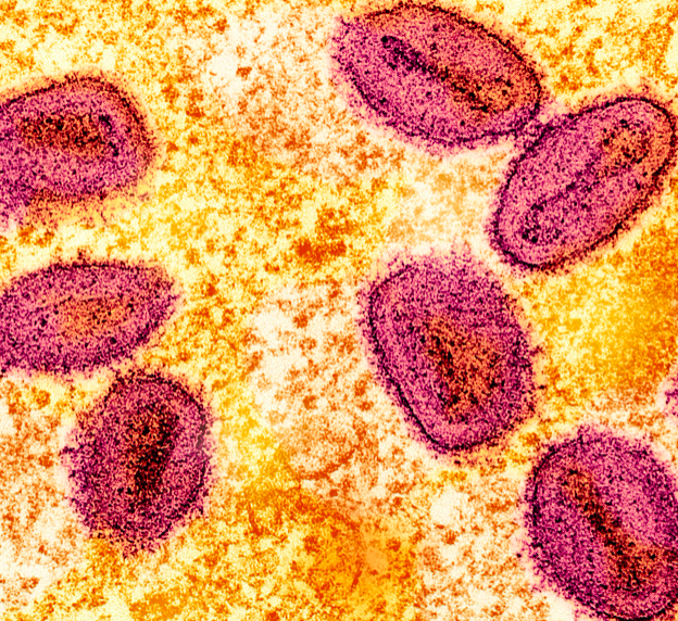 Mpox