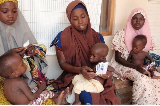 Nigeria Malnourished