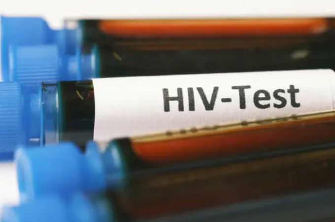 HIV/AIDS