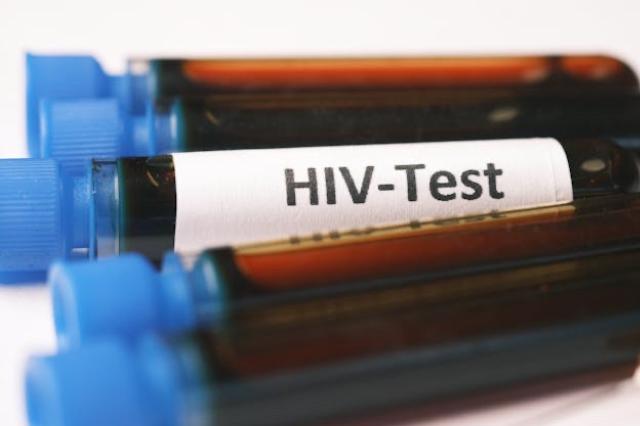 South African lab to produce new HIV treatment in Africa: Unitaid
