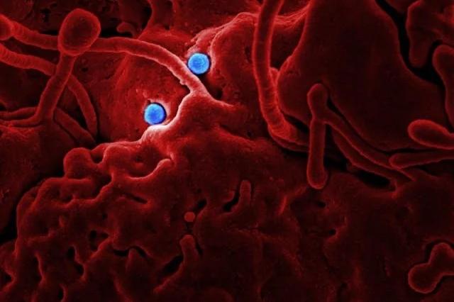 New Ebola outbreak in DR Congo: What we know